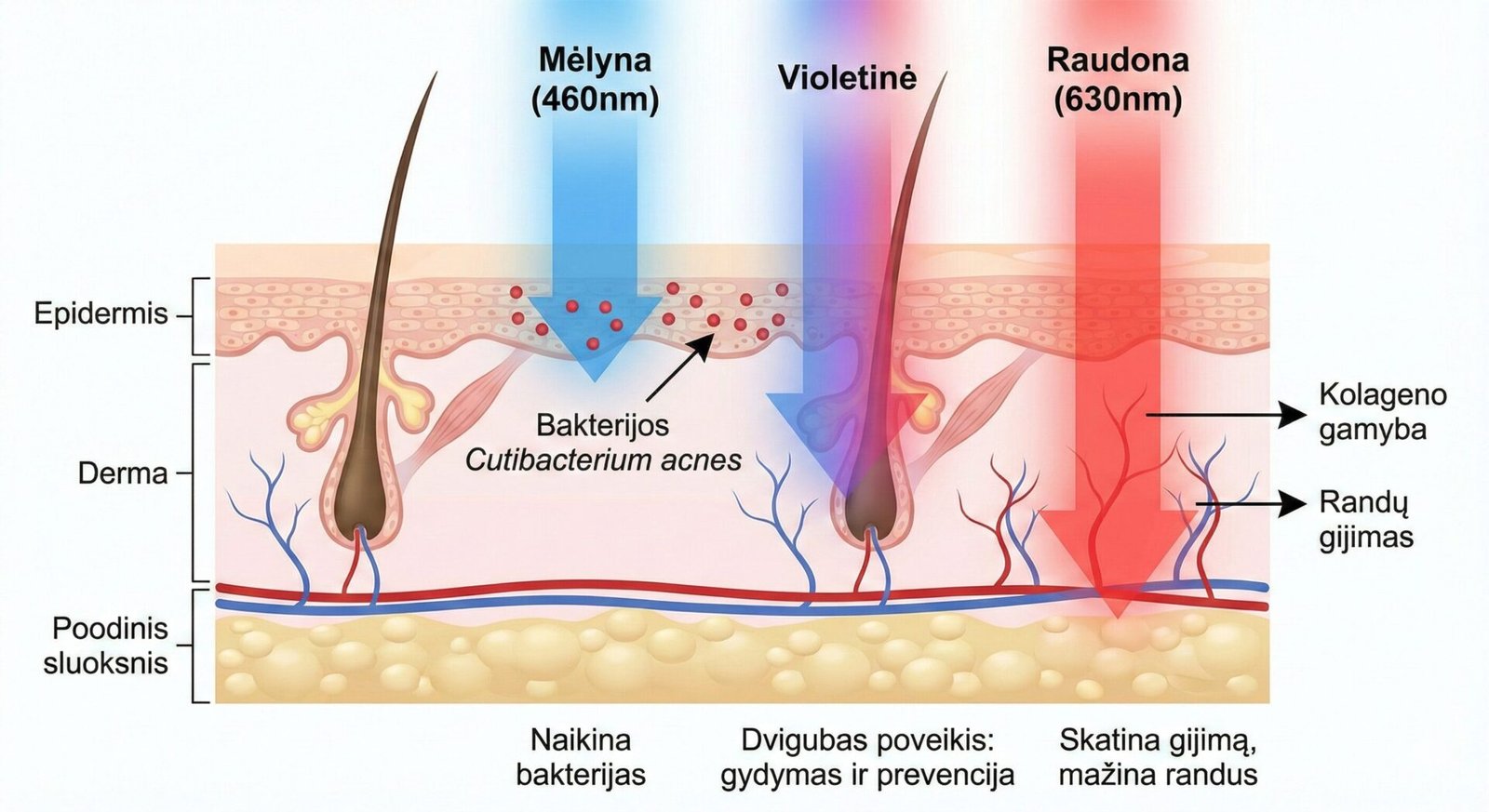 Violetinė ir raudona LED šviesa aknės randų gydymui